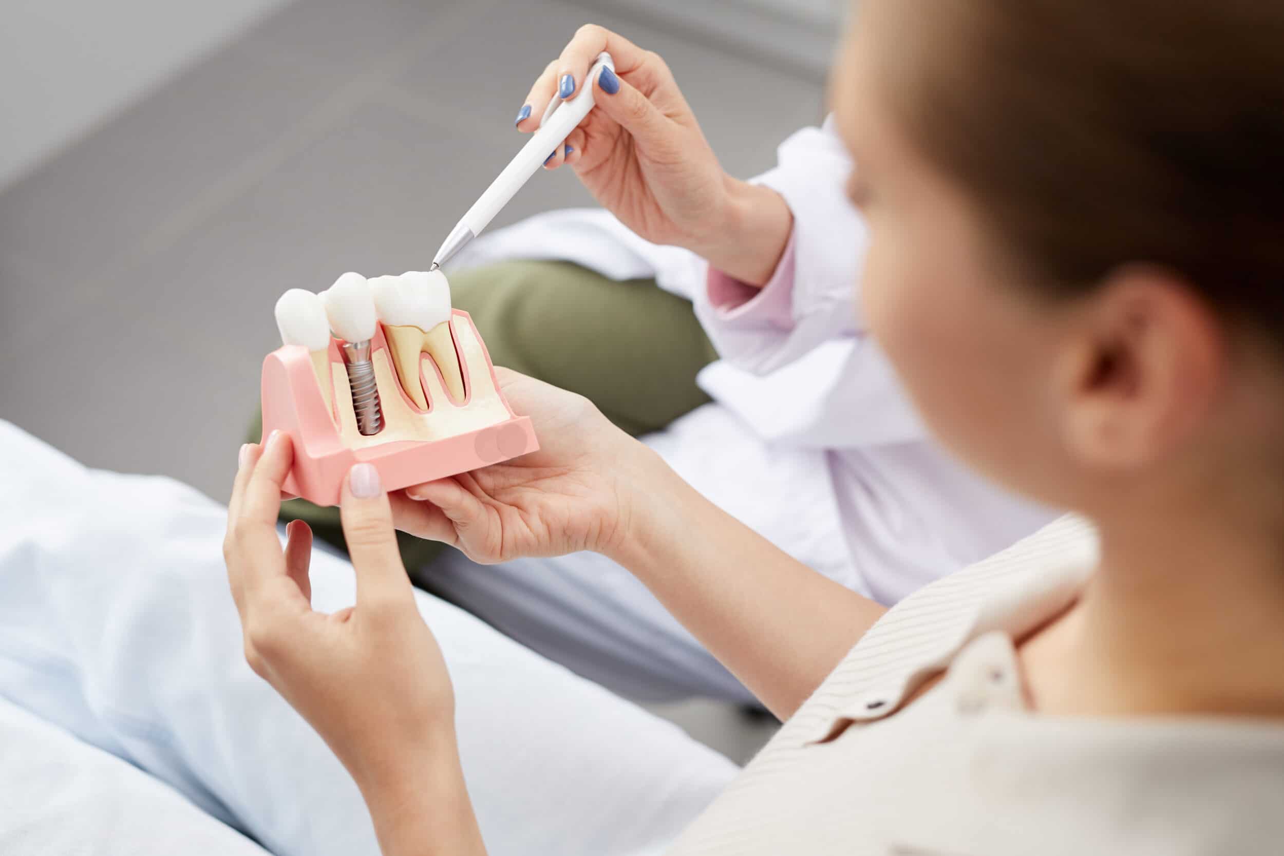 female patient holding model of gum with dental implants