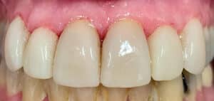 After Image: PROVÁNCE® CASE 26