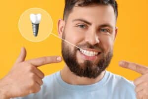 Smiling young man showing his dental implants