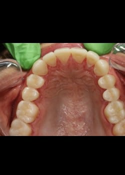 After Image: Provánce® Case 6 - front